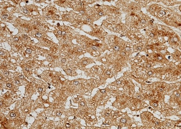Recombinant C5a/Complement 5a Monoclonal Antibody (AN300198P)