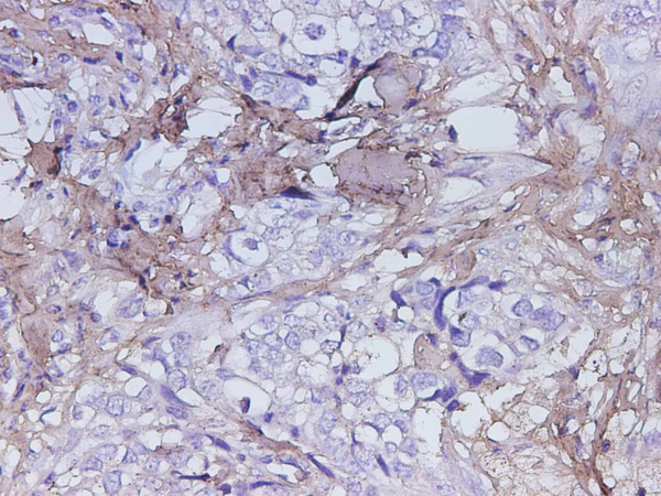 POSTN Polyclonal Antibody (D-AB-10363L)