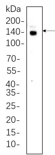 Recombinant CTCF Monoclonal Antibody (AN300709L)