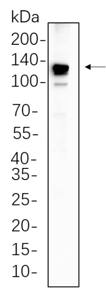 Recombinant PYK2 Monoclonal Antibody (AN300636L)