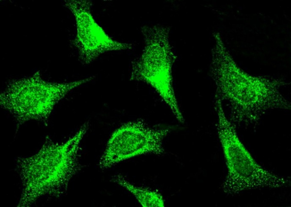 PAK1 Antibody Polyclonal Antibody (AN100004P)