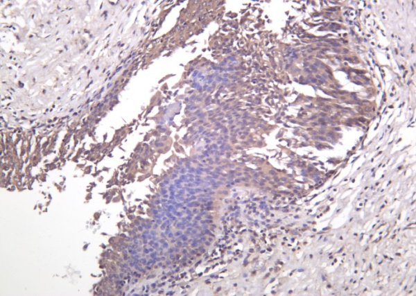 Recombinant MEK-7 Monoclonal Antibody (AN301266L)