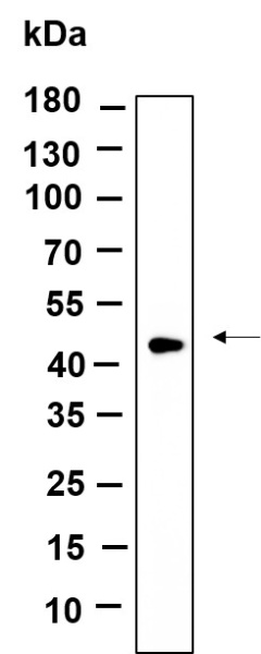 Recombinant TPST2 Monoclonal Antibody (AN301226L)