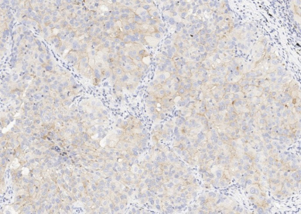 CD47 Monoclonal Antibody (AN200128P)