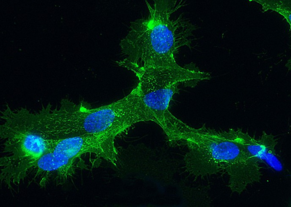 Recombinant E-Selectin/CD62e/SELE Monoclonal Antibody (AN300322P)