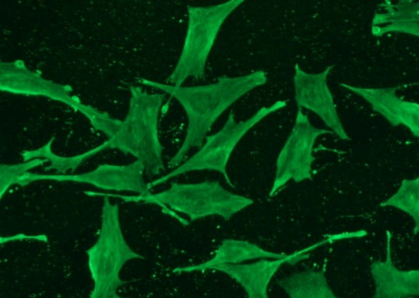 Recombinant ISG15 Monoclonal Antibody (AN300127P)