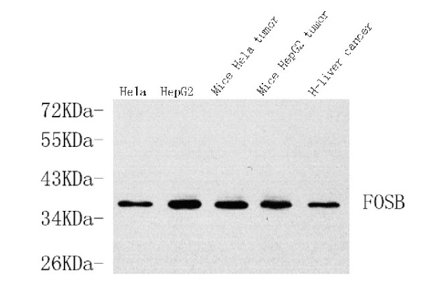 FOSB Polyclonal Antibody (E-AB-70129)