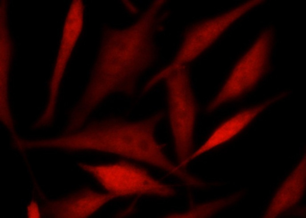 Recombinant TSC22D1 Monoclonal Antibody (AN300428P)