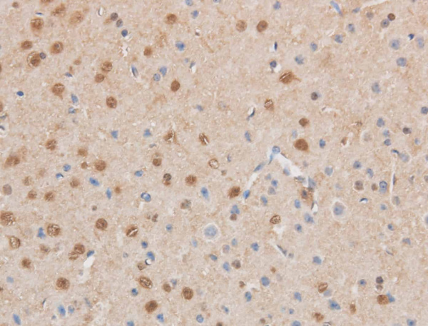 MAP2K6 Polyclonal Antibody (E-AB-40167)