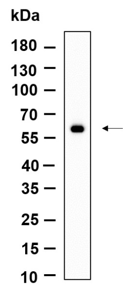 Recombinant PAKγ Monoclonal Antibody (AN301192L)