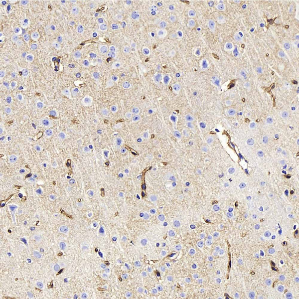 AQP4 Polyclonal Antibody (E-AB-70385)