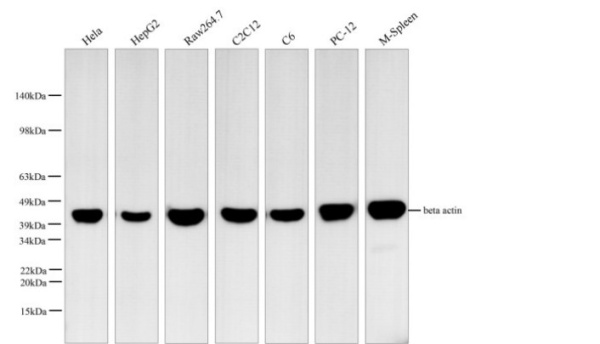 beta actin Monoclonal Antibody (AN005290L)