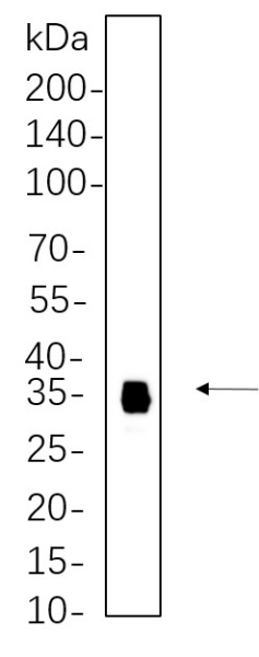 Recombinant Slug Monoclonal Antibody (AN301355L)