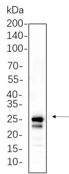 Recombinant mtTFA Monoclonal Antibody (AN300802L)