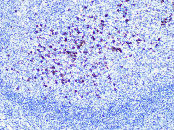 CD38 Monoclonal Antibody (ELAB6153-R)