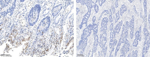 Recombinant Phospho-p38 MAPK (Thr180, Tyr182) Monoclonal Antibody (AN300364L)