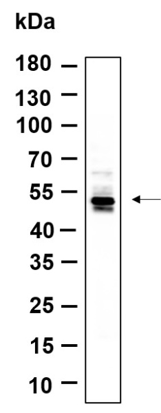 Recombinant Phospho-CaMKII α, β (Thr286) Monoclonal Antibody (AN301143L)