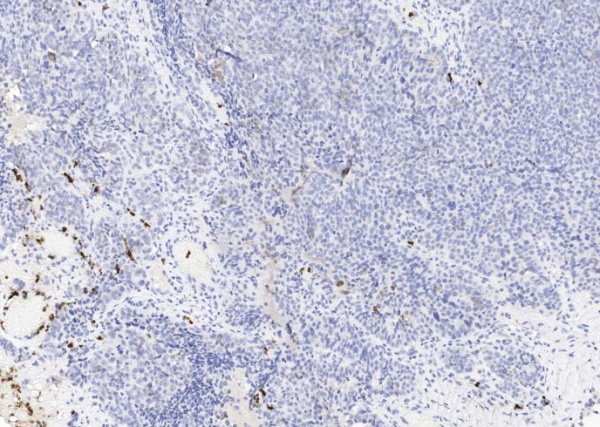 Recombinant Lipocalin-2/LCN2 Monoclonal Antibody (AN300308P)