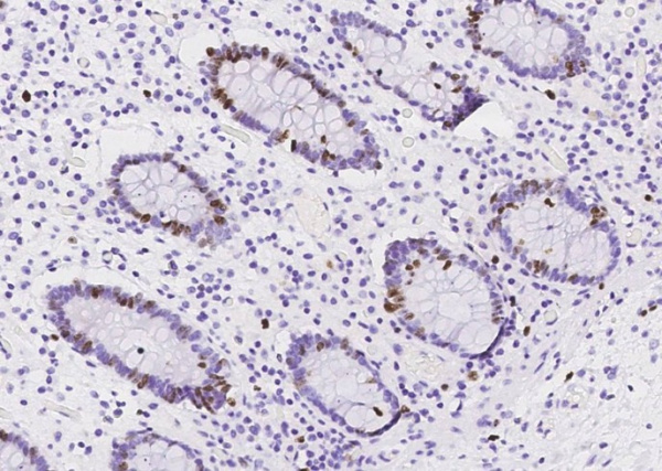 Ki67/MKI67 Monoclonal Antibody (AN200153P)