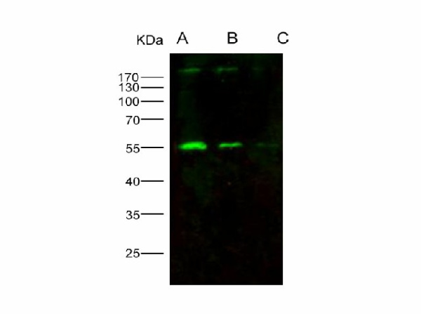 Anti-HIV-p51/RT-p51(group M, subtype B(isolate HXB2) Gag-Pol polyprotein Polyclonal Antibody (E-AB-V1239)