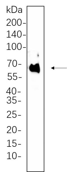 Recombinant PDPK1 Monoclonal Antibody (AN300667L)