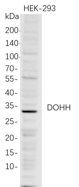 Recombinant DOHH Monoclonal Antibody (AN300784L)
