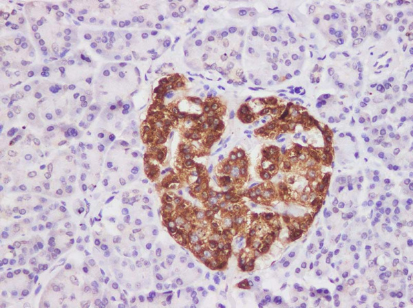 CHGA Polyclonal Antibody (AN005870L)