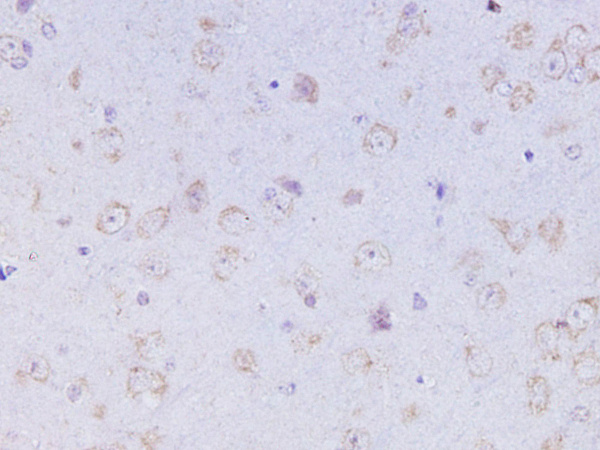 OXA Polyclonal Antibody (D-AB-10449L)
