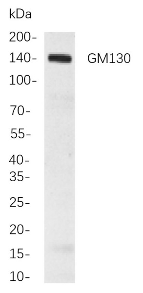 Recombinant GM130 Monoclonal Antibody (AN300891L)