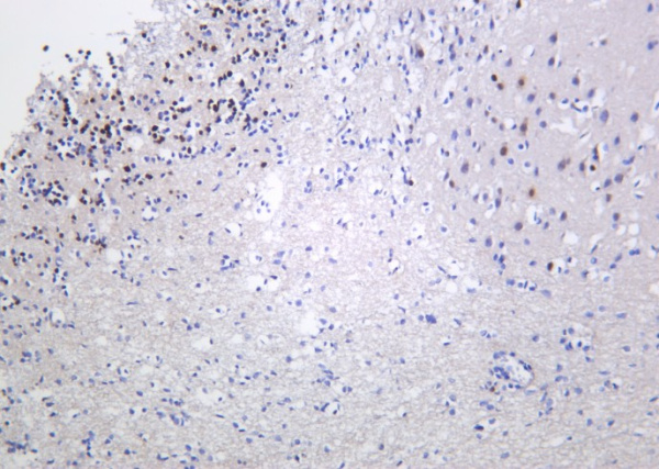 Recombinant Fos B Monoclonal Antibody (AN301272L)