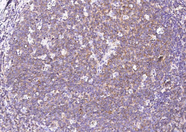 Recombinant CD150/SLAM/SLAMF1 Monoclonal Antibody (AN300350P)