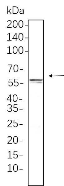 Recombinant E2F-1 Monoclonal Antibody (AN301368L)