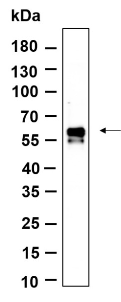 Recombinant Phospho-IRF3 (Ser386) Monoclonal Antibody (AN301384L)