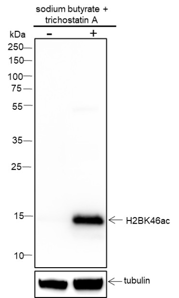 Recombinant Histone H2B (Acetyl Lys46) Monoclonal Antibody (AN301406L)