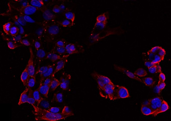 Recombinant Chromogranin A/CHGA/CGA Monoclonal Antibody (AN300073P)