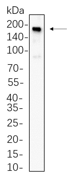 Recombinant Met Monoclonal Antibody (AN300725L)