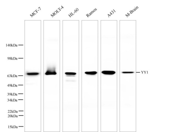 YY1 Monoclonal Antibody (AN005360L)