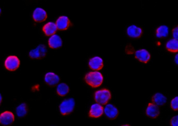 Recombinant IFNAR1 Monoclonal Antibody (AN300522P)