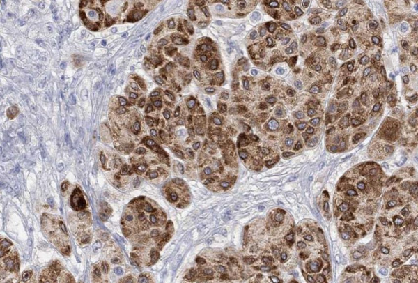 Tyrosinase Monoclonal Antibody (ELAB6563-M)