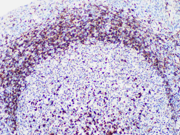 CD79a Monoclonal Antibody (ELAB6614-M)