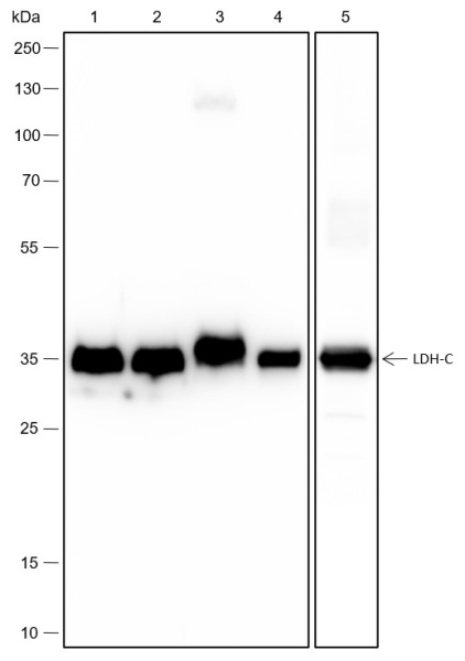 Recombinant LDHC Monoclonal Antibody (AN301735L)