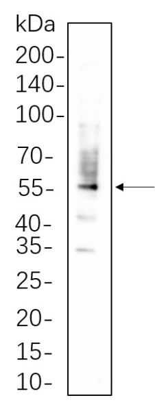 Recombinant PDI Monoclonal Antibody (AN300824L)