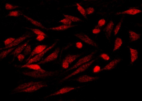 Recombinant S100P Monoclonal Antibody (AN300132P)