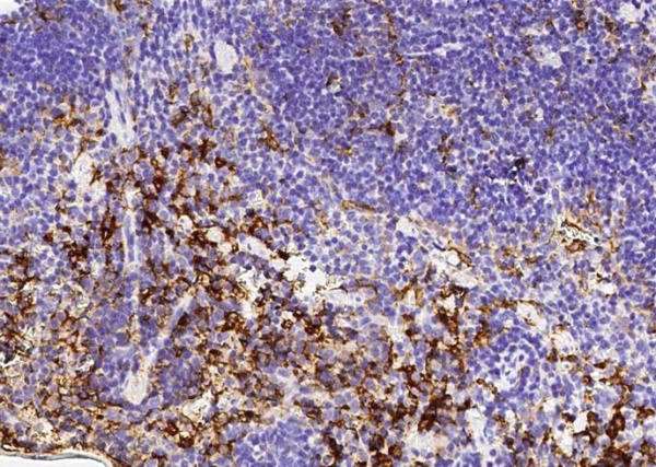 Recombinant NAALADL1 Monoclonal Antibody (AN300568P)