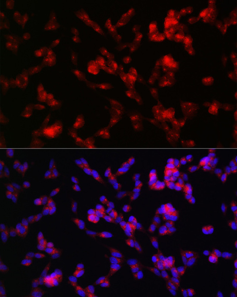 ADAMTS4 Polyclonal Antibody (E-AB-93370)
