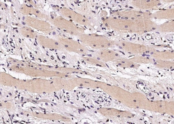 Recombinant STUB1 Monoclonal Antibody (AN300115P)