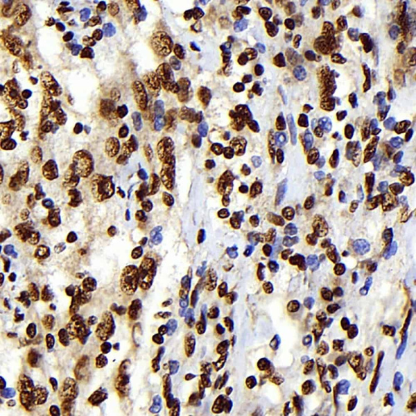 S100A4 Monoclonal Antibody (E-AB-70355)