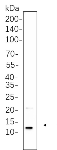 Recombinant Insulin Monoclonal Antibody (AN301325L)