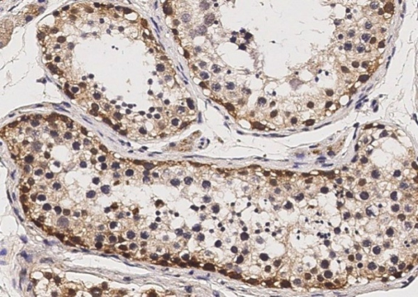 Recombinant Sox2 Monoclonal Antibody (AN300133P)