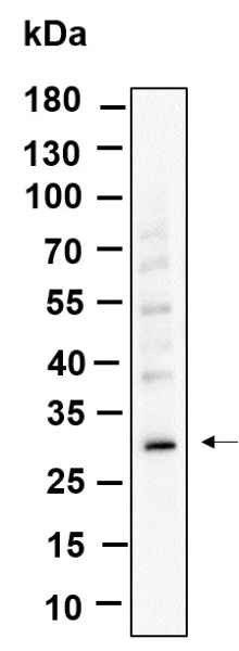 Recombinant ZWINT Monoclonal Antibody (AN301236L)